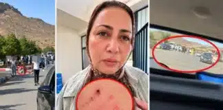 اعتداء على صحافية وطاقم «شوف تيفي» بو